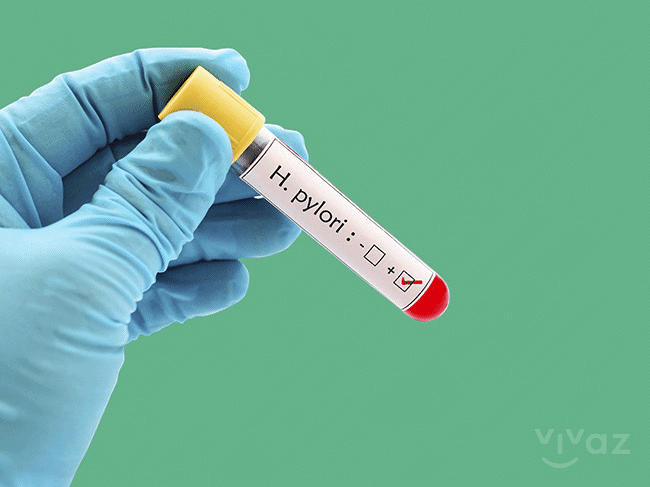 ¿Cuáles son los síntomas de la bacteria Helicobacter pylori?